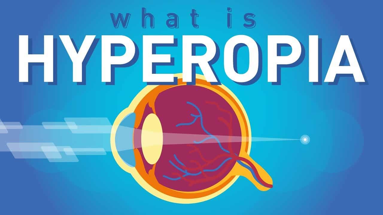 Hypperopia