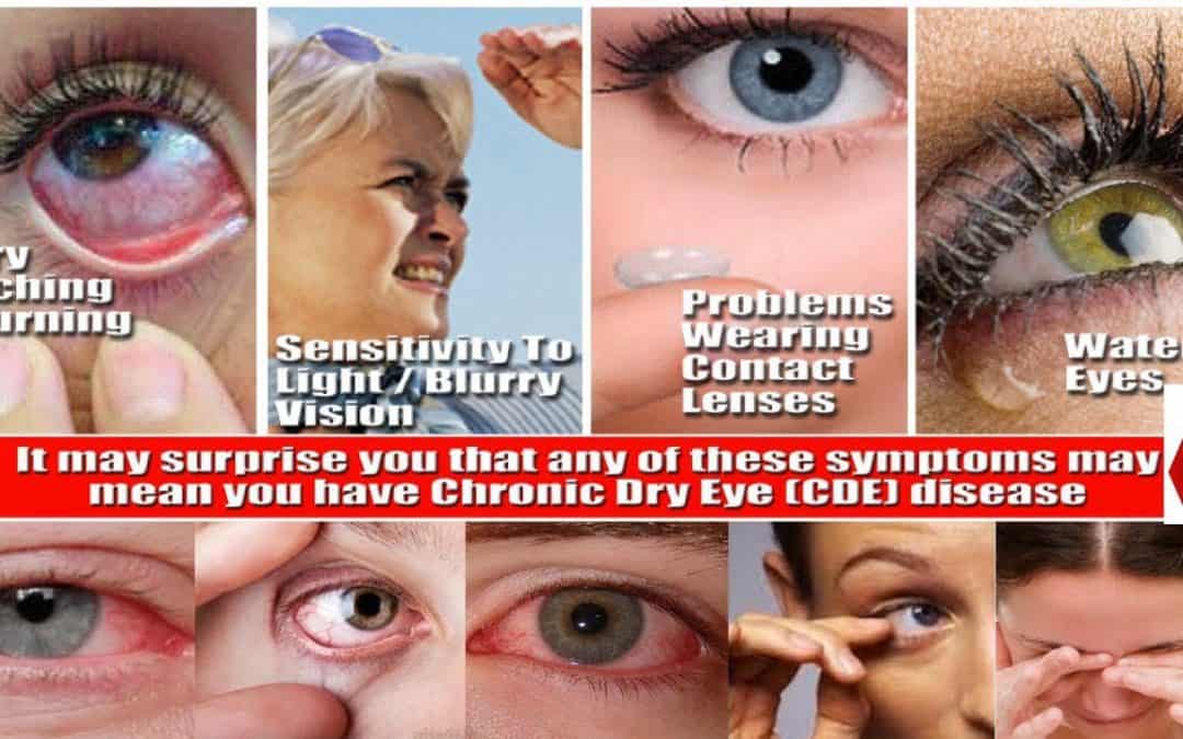 Signs and Symptoms of Vision Problems آنکھوں کے مسائل کی علامات