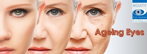 Ageing Eyes