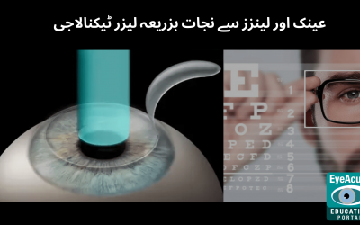 عینک اور لینزز سے نجات بزریعہ لیزر ٹیکنالاجی