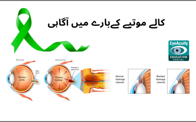 Glaucoma Awareness in Urdu